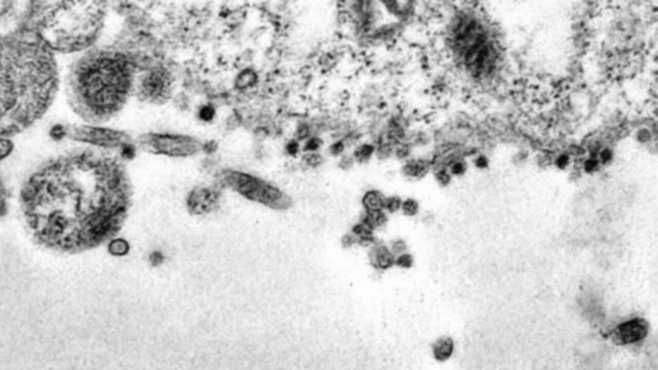 Koronavirüsün Hücrelere Saldırsı Görüntülendi. Siyah noktalar virüs.
