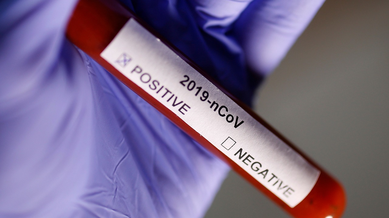 Koronavirüs Testinin Önemi ve Ülkelere Etkileri